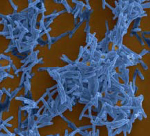 L’histoire évolutive et l’émergence de la tuberculose retracées