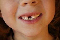 Campagne de sensibilisation bucco-dentaire : « Souriez, vous êtes bien protégés avec la MNT »