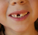 Campagne de sensibilisation bucco-dentaire : « Souriez, vous êtes bien protégés avec la MNT »